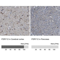 P2Y12/P2RY12 Antibody, Novus Biologicals 0.1mL; Unlabeled:Antibodies, Polyclonal